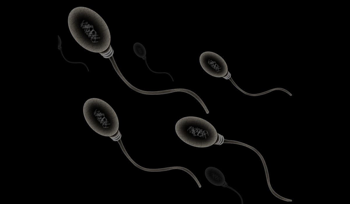 what affects sperm quality image