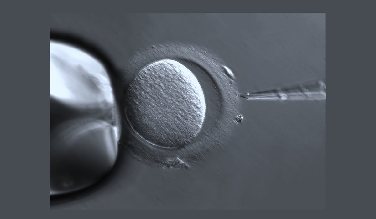 ivf process - sperm injection