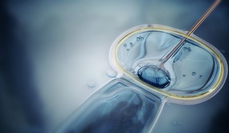 intracytoplasmic sperm injection main image