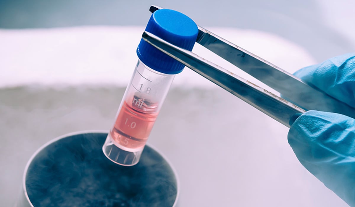 cryopreservation - egg freezing image