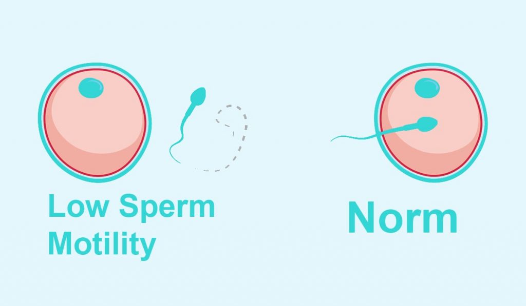 normal and low sperm motility