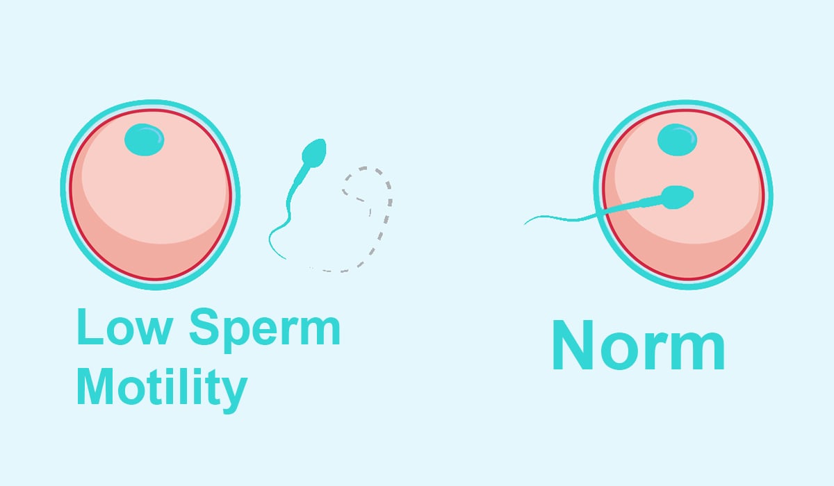 normal and low sperm motility