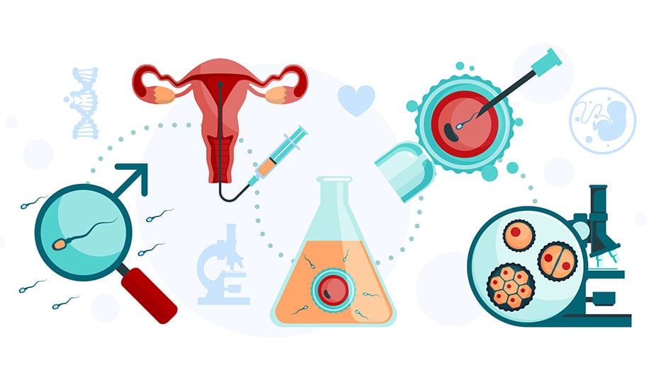 IVF fertilization if egg with sperm