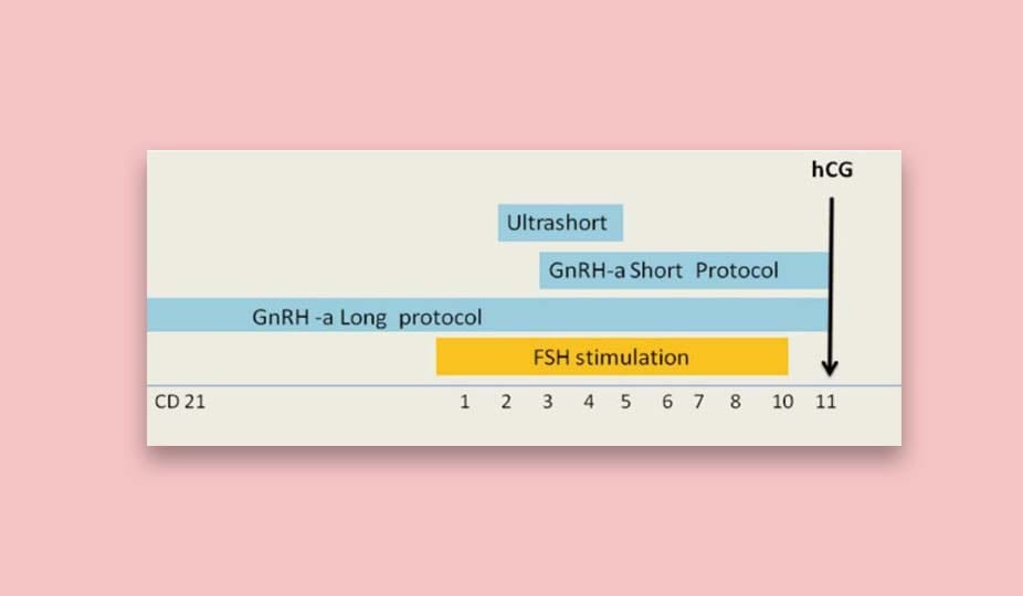 short and long ivf protocoles with leuprorelin-min