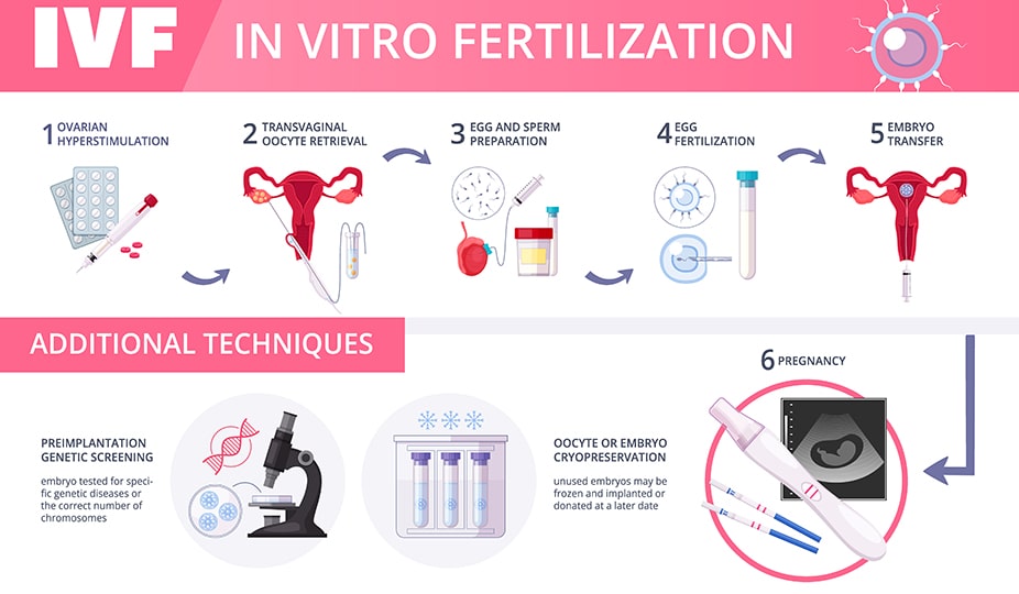 the IVF process