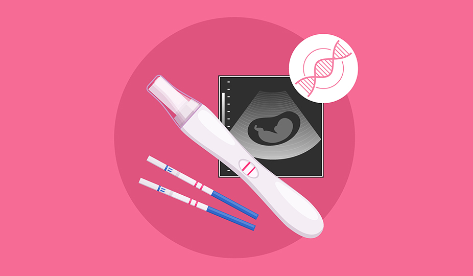 IUI pregnancy