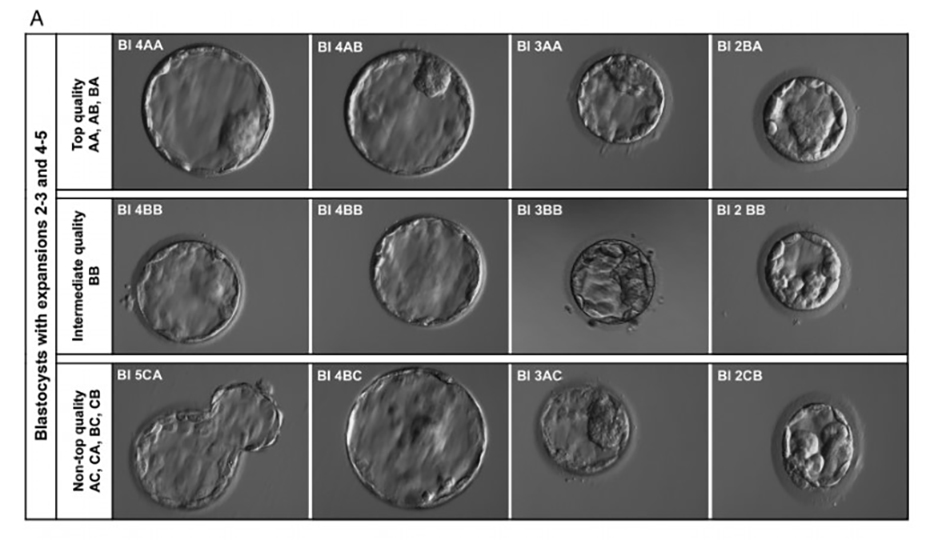 IVF embryo grading