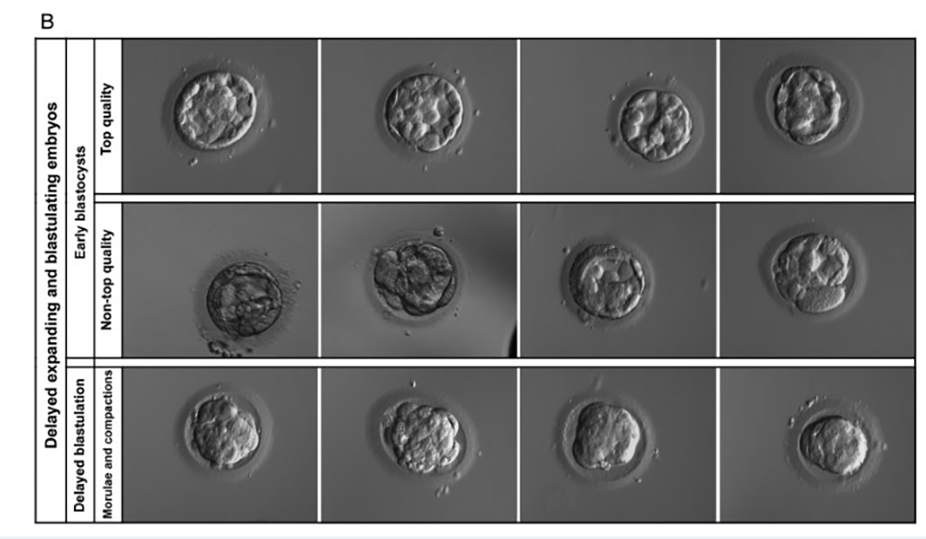 embryo quality embryo grading chart