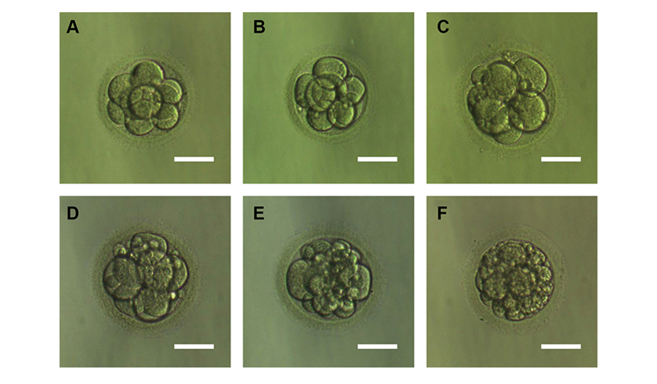 embryo grading chart