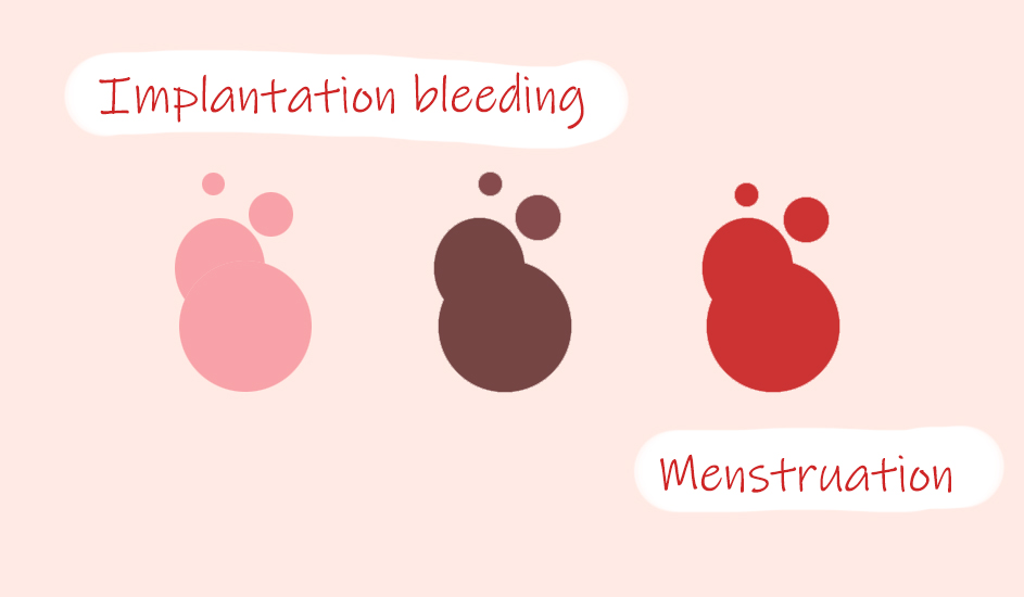 image showing difference between implantation bleeding and menstruation