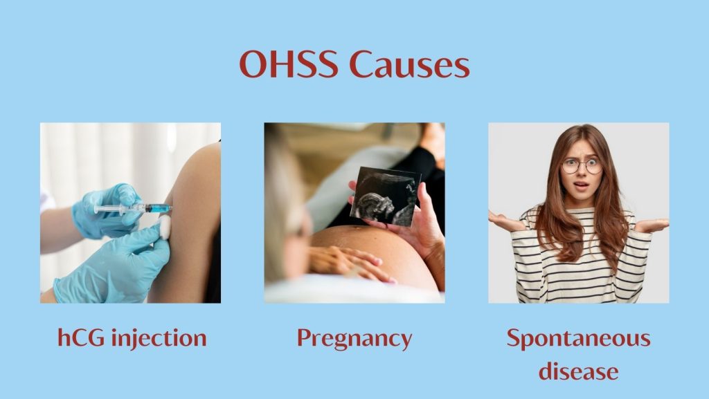 OHSS ovarian hyperstimulation causes and reasons
