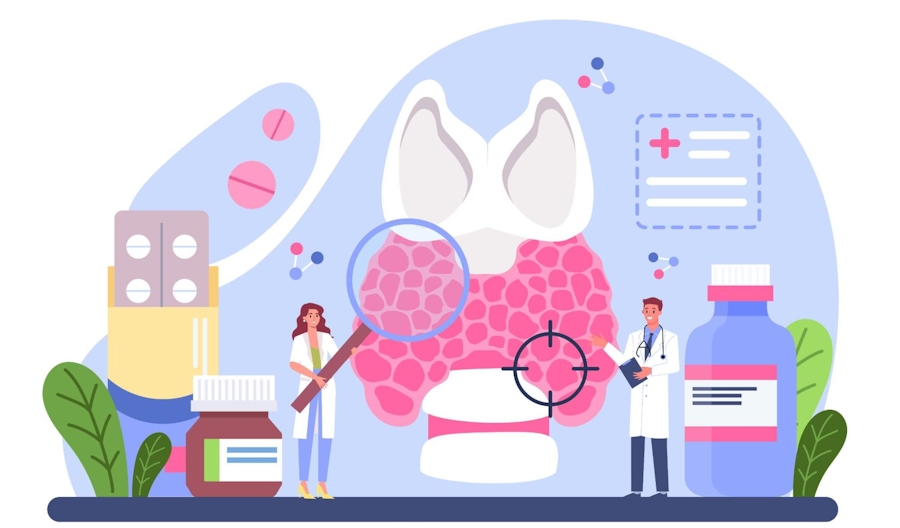 what is hashimoto's disease - thyroid gland image